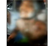 காதலியை மணக்க முடியாததால் இளைஞர் தீக்குளிப்பு !