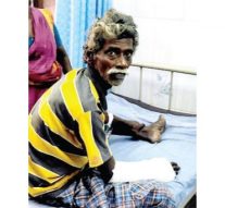 காரைக்குடி | பைக்கை திருட முயன்றவர்களை தடுத்த வியாபாரிக்கு வெட்டு